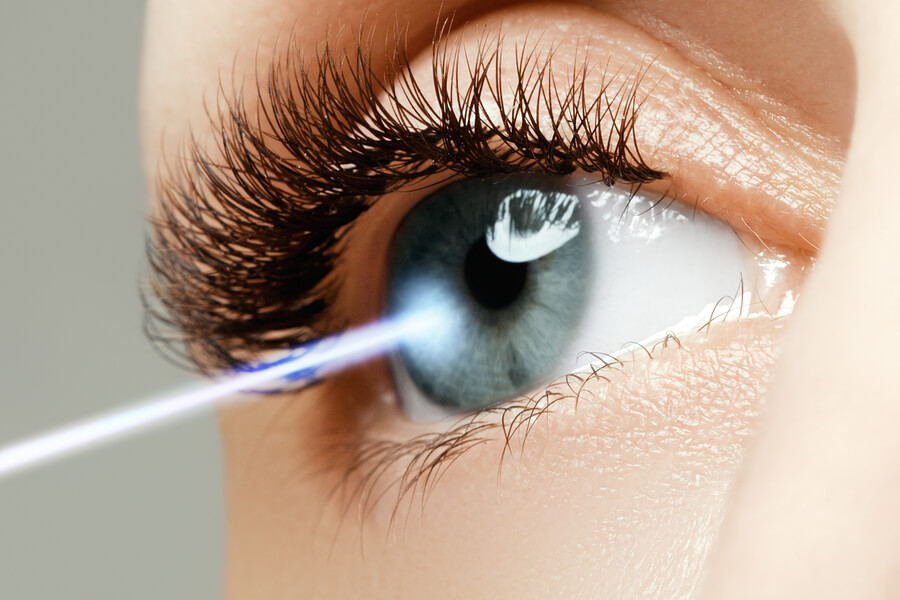 4 Great Benefits of LASIK