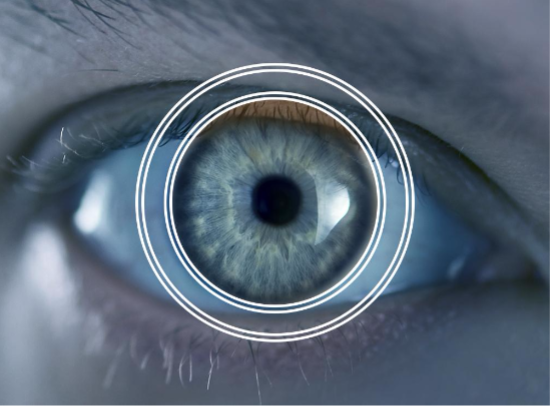 Understanding the Two Major Forms of Glaucoma