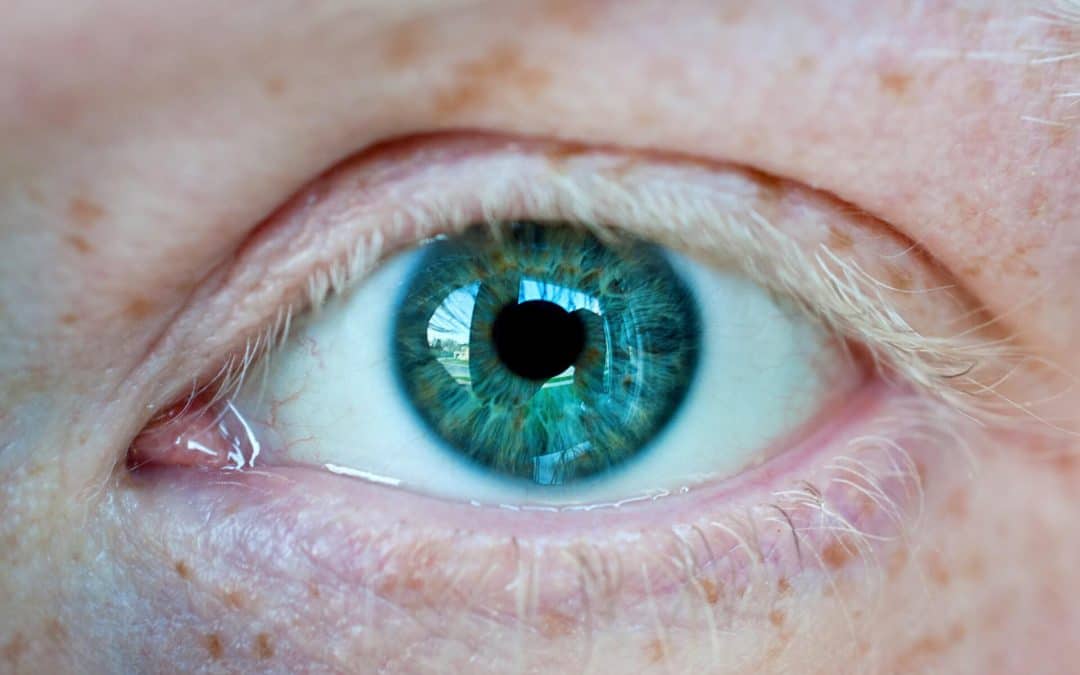 New Eyedrops Can Treat Droopy Eyelids (Ptosis)