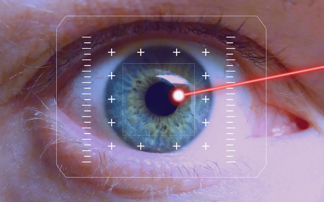 Aftercare for Glaucoma Laser Treatment