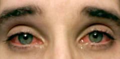 Ways to Prevent Viral Eye Infections (Pink Eye)